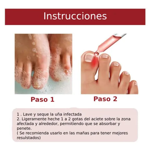 ANTI UÑEROS TOENAIL PLUS