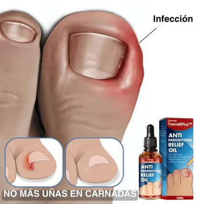 ANTI UÑEROS TOENAIL PLUS